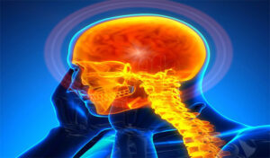 Common Causes of Brain Injury and Head Trauma