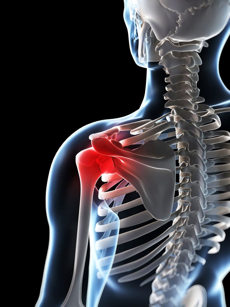 Types Personal Injury Cases Involving Shoulder Injuries