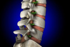 Types of Spinal Cord Injuries